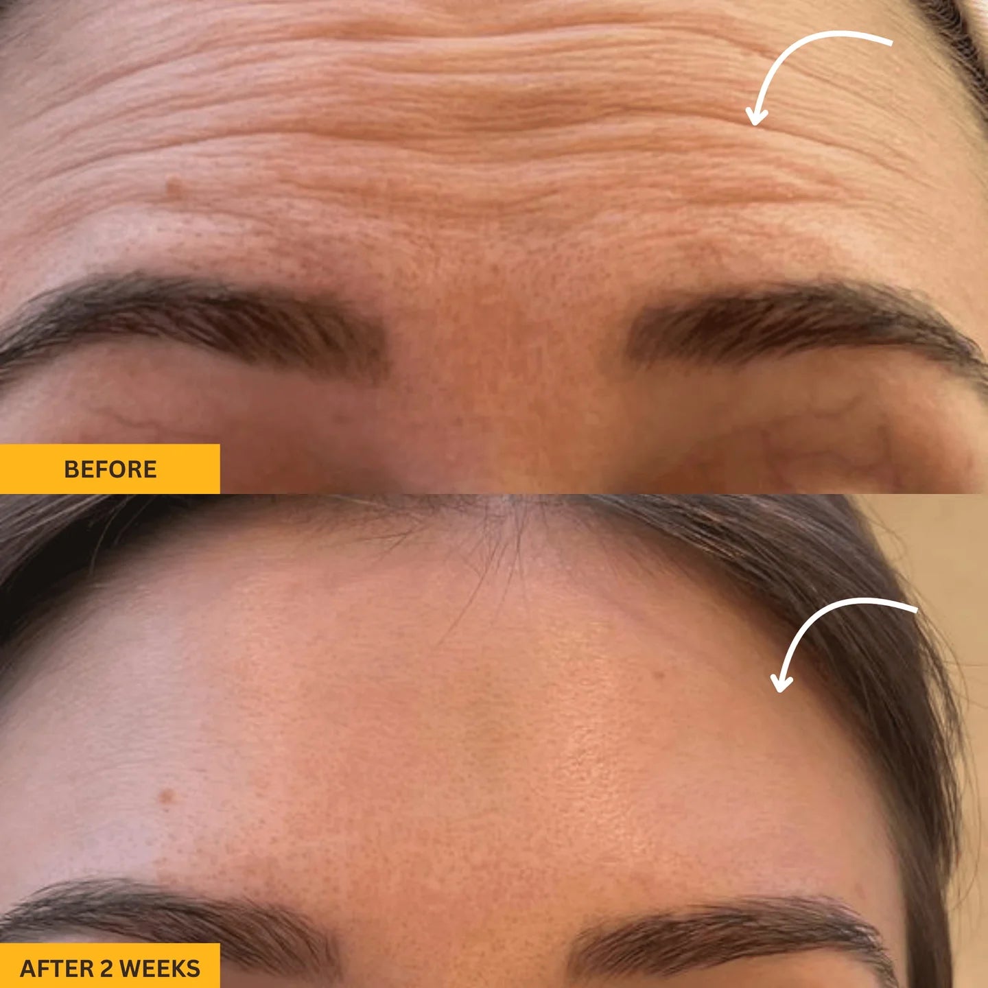 Lymphatic Gua Sha Brush for Snatched Face