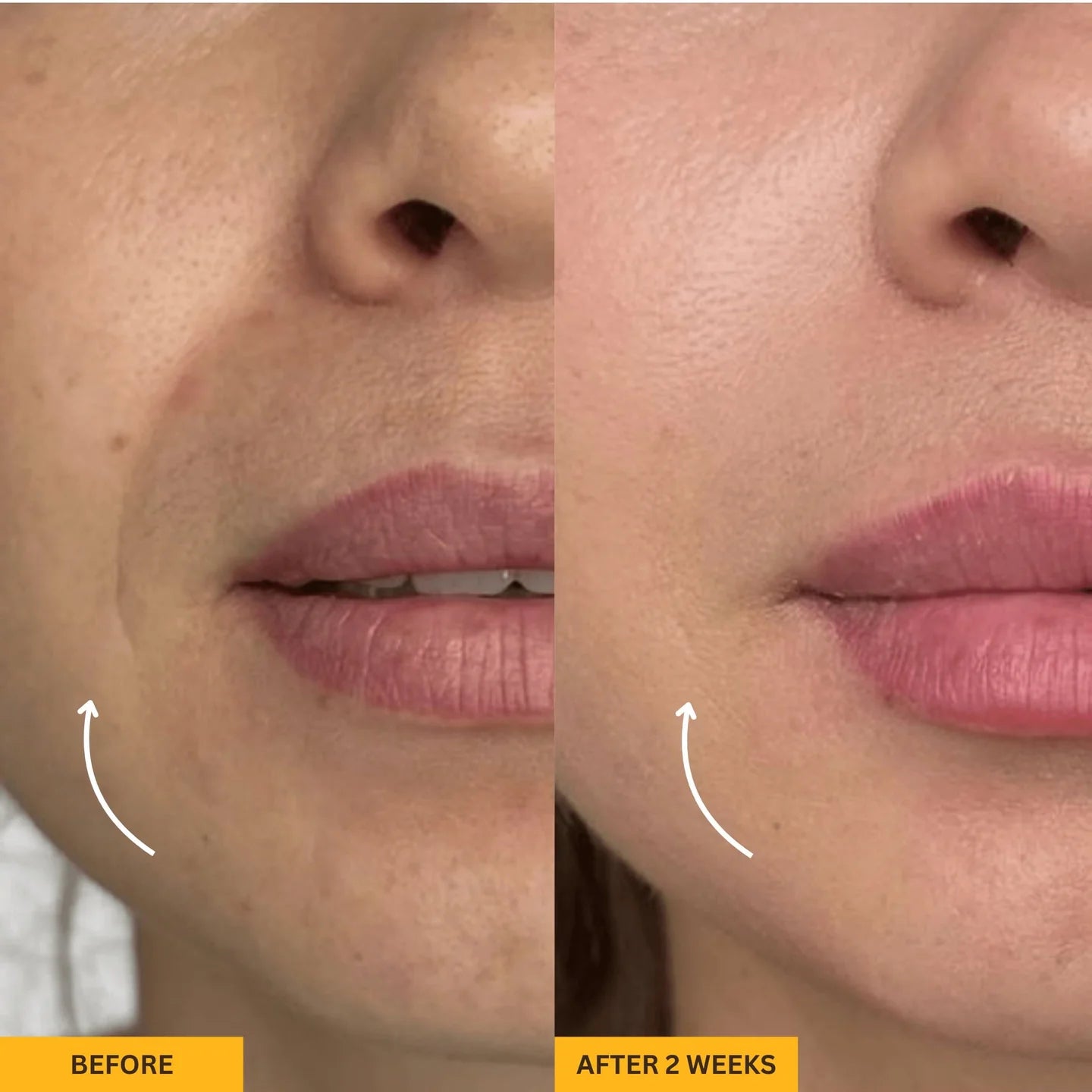 Lymphatic Gua Sha Brush for Snatched Face