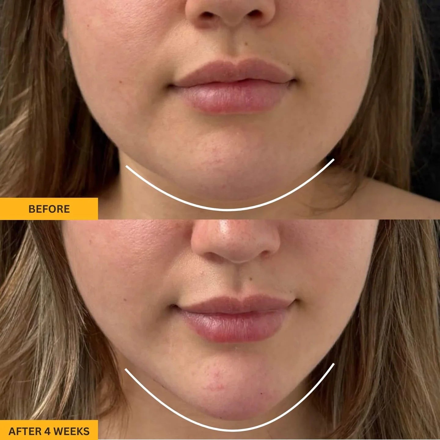 Lymphatic Gua Sha Brush for Snatched Face